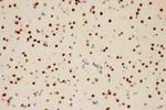 PIAS1 Antibody in Immunohistochemistry (Paraffin) (IHC (P))