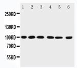 PIAS1 Antibody in Western Blot (WB)