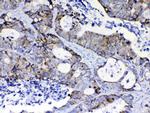 PIK3CB Antibody in Immunohistochemistry (Paraffin) (IHC (P))