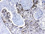 PIK3CB Antibody in Immunohistochemistry (Paraffin) (IHC (P))