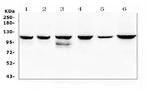 PIK3CB Antibody in Western Blot (WB)