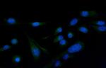 PLCG2 Antibody in Immunocytochemistry (ICC/IF)