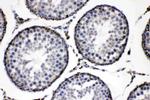 ADFP Antibody in Immunohistochemistry (Paraffin) (IHC (P))