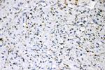 ADFP Antibody in Immunohistochemistry (Paraffin) (IHC (P))