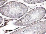 ADFP Antibody in Immunohistochemistry (Paraffin) (IHC (P))