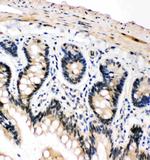 PLK2 Antibody in Immunohistochemistry (Paraffin) (IHC (P))