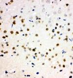 PLK2 Antibody in Immunohistochemistry (Paraffin) (IHC (P))