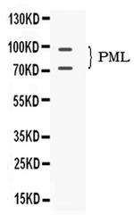 PML Antibody in Western Blot (WB)
