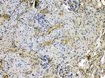 PNP Antibody in Immunohistochemistry (Paraffin) (IHC (P))