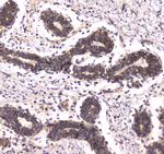 POLR2A Antibody in Immunohistochemistry (Paraffin) (IHC (P))