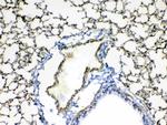 Periostin Antibody in Immunohistochemistry (Paraffin) (IHC (P))