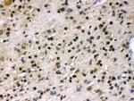 MYPT1 Antibody in Immunohistochemistry (Paraffin) (IHC (P))