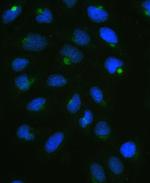 CPI-17 Antibody in Immunocytochemistry (ICC/IF)