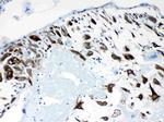 CPI-17 Antibody in Immunohistochemistry (Paraffin) (IHC (P))