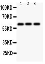 Perforin Antibody in Western Blot (WB)