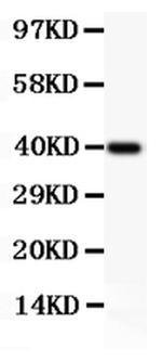 Perforin Antibody in Western Blot (WB)