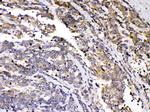 PRKAR1A Antibody in Immunohistochemistry (Paraffin) (IHC (P))