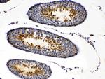 PRKAR1A Antibody in Immunohistochemistry (Paraffin) (IHC (P))