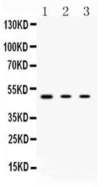 PRKAR1A Antibody in Western Blot (WB)