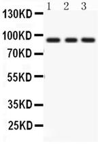 PKC epsilon Antibody in Western Blot (WB)