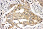 Prolactin Receptor Antibody in Immunohistochemistry (Paraffin) (IHC (P))