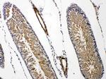 Prolactin Receptor Antibody in Immunohistochemistry (Paraffin) (IHC (P))