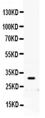 PrP Antibody in Western Blot (WB)