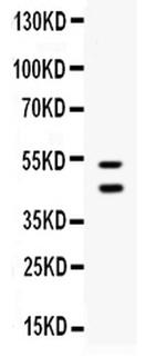 EPCR Antibody in Western Blot (WB)