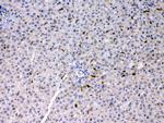 PSAT1 Antibody in Immunohistochemistry (Paraffin) (IHC (P))