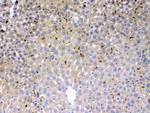 PSAT1 Antibody in Immunohistochemistry (Paraffin) (IHC (P))