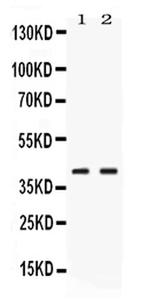 PSAT1 Antibody in Western Blot (WB)