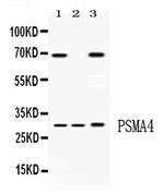 PSMA4 Antibody in Western Blot (WB)