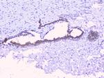 PTP1B Antibody in Immunohistochemistry (Paraffin) (IHC (P))