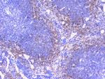 PTP1B Antibody in Immunohistochemistry (Paraffin) (IHC (P))