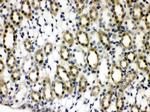 PTPN2 Antibody in Immunohistochemistry (Paraffin) (IHC (P))