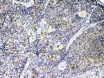 PTPN22 Antibody in Immunohistochemistry (Paraffin) (IHC (P))