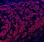 Paxillin Antibody in Immunohistochemistry (Paraffin) (IHC (P))