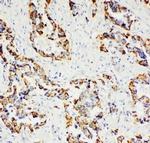 Paxillin Antibody in Immunohistochemistry (Paraffin) (IHC (P))