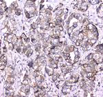 RAB27A Antibody in Immunohistochemistry (Paraffin) (IHC (P))