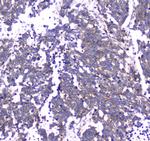 RAB27A Antibody in Immunohistochemistry (Paraffin) (IHC (P))