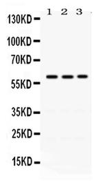 RAG2 Antibody in Western Blot (WB)