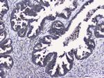 RALBP1 Antibody in Immunohistochemistry (Paraffin) (IHC (P))