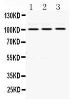 RASA1 Antibody in Western Blot (WB)