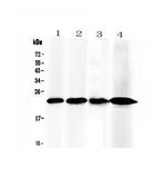 RBP4 Antibody in Western Blot (WB)