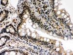 c-Rel Antibody in Immunohistochemistry (Paraffin) (IHC (P))