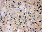 ROCK2 Antibody in Immunohistochemistry (Paraffin) (IHC (P))