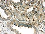 ROCK2 Antibody in Immunohistochemistry (Paraffin) (IHC (P))