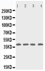 p53R2 Antibody in Western Blot (WB)