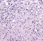 RUNX1T1 Antibody in Immunohistochemistry (Paraffin) (IHC (P))