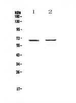 RUNX1T1 Antibody in Western Blot (WB)